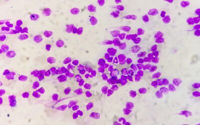 Grzyby Malassezia: Niewidzialny lokator Twojej skóry. Kiedy przyjaciel staje się wrogiem?