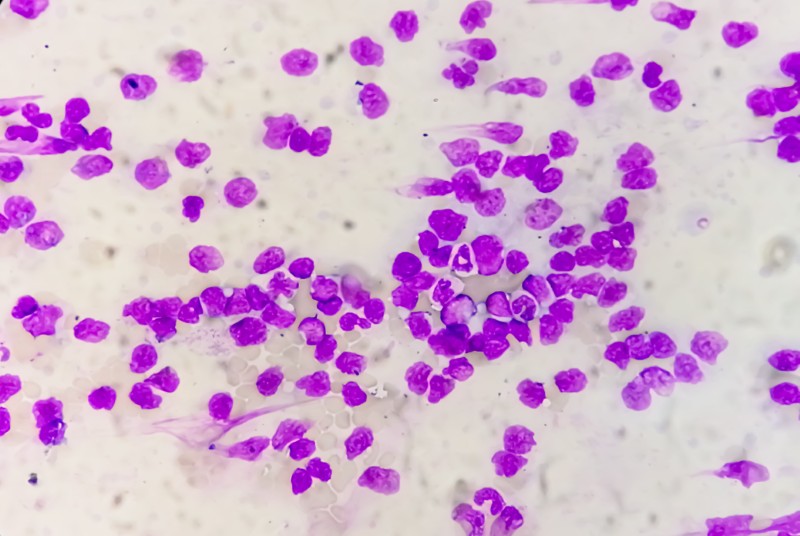 Grzyby Malassezia: Niewidzialny lokator Twojej skóry. Kiedy przyjaciel staje się wrogiem?