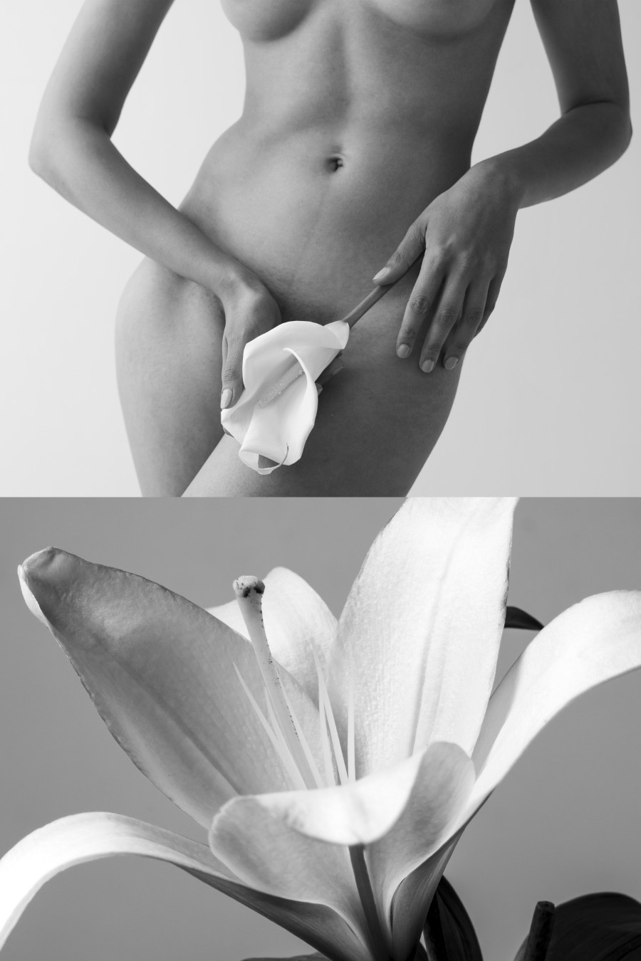 zabieg monalisa touch