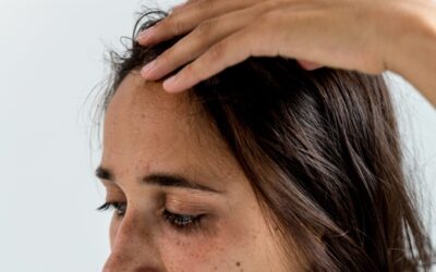 Trądzik martwiczy (Acne Necrotica): Gdy świąd i blizny są gorsze niż krosty. Jak go rozpoznać?