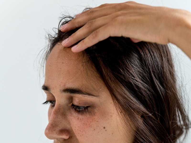 Trądzik martwiczy (Acne Necrotica): Gdy świąd i blizny są gorsze niż krosty. Jak go rozpoznać?